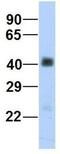 Sarcoglycan Beta antibody, GTX46747, GeneTex, Western Blot image 