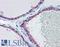 Fibroblast growth factor receptor 2 antibody, LS-B5979, Lifespan Biosciences, Immunohistochemistry paraffin image 
