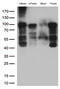 B-Raf Proto-Oncogene, Serine/Threonine Kinase antibody, M00075-3, Boster Biological Technology, Western Blot image 