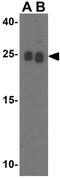 RPA Interacting Protein antibody, GTX85485, GeneTex, Western Blot image 