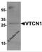 V-Set Domain Containing T Cell Activation Inhibitor 1 antibody, 7189, ProSci Inc, Western Blot image 