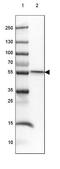 SET And MYND Domain Containing 1 antibody, NBP2-38957, Novus Biologicals, Western Blot image 