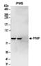 Phosphofructokinase, Platelet antibody, NBP2-32083, Novus Biologicals, Immunoprecipitation image 