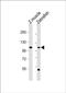 Protein HEG antibody, PA5-72634, Invitrogen Antibodies, Western Blot image 