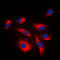Mitogen-Activated Protein Kinase Kinase 1 antibody, LS-C354253, Lifespan Biosciences, Immunofluorescence image 