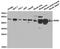 Retinoic Acid Receptor Alpha antibody, TA326833, Origene, Western Blot image 