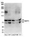 RUN And FYVE Domain Containing 1 antibody, A304-884A, Bethyl Labs, Western Blot image 
