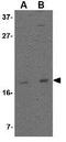 Developmental pluripotency-associated protein 3 antibody, GTX85384, GeneTex, Western Blot image 