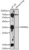 PICALM Interacting Mitotic Regulator antibody, 16-501, ProSci, Western Blot image 