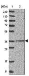 DNA Replication And Sister Chromatid Cohesion 1 antibody, NBP2-33275, Novus Biologicals, Western Blot image 