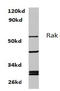 RAK antibody, AP06691PU-N, Origene, Western Blot image 