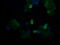 TAP Binding Protein Like antibody, M09482-1, Boster Biological Technology, Immunofluorescence image 