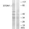 Stonin-1 antibody, A13140, Boster Biological Technology, Western Blot image 