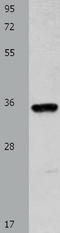 Cytochrome C Oxidase Copper Chaperone COX11 antibody, TA323960, Origene, Western Blot image 