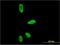 ASE-1 antibody, H00010849-M05, Novus Biologicals, Immunocytochemistry image 