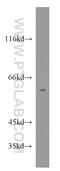Retinoid X Receptor Beta antibody, 14684-1-AP, Proteintech Group, Western Blot image 