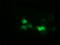 EPM2A-interacting protein 1 antibody, TA501930, Origene, Immunofluorescence image 