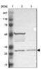 PH Domain Containing Endocytic Trafficking Adaptor 2 antibody, NBP1-84112, Novus Biologicals, Western Blot image 
