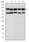 Bone Morphogenetic Protein Receptor Type 2 antibody, M00324, Boster Biological Technology, Western Blot image 