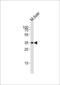 H6 Family Homeobox 2 antibody, 62-778, ProSci, Western Blot image 
