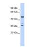 HtrA Serine Peptidase 4 antibody, NBP1-62690, Novus Biologicals, Western Blot image 