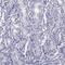 Stromal Antigen 3 antibody, HPA058330, Atlas Antibodies, Immunohistochemistry paraffin image 