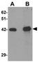 Solute Carrier Family 39 Member 12 antibody, GTX31818, GeneTex, Western Blot image 
