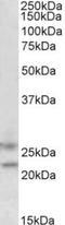F-Box Protein 44 antibody, TA311609, Origene, Western Blot image 