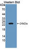 CGAS antibody, LS-C375066, Lifespan Biosciences, Western Blot image 