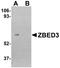 Zinc Finger BED-Type Containing 3 antibody, NBP1-77348, Novus Biologicals, Western Blot image 
