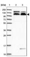 RAB11 Binding And LisH Domain, Coiled-Coil And HEAT Repeat Containing antibody, NBP1-93851, Novus Biologicals, Western Blot image 