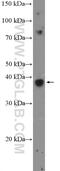 DNA repair protein XRCC3 antibody, 18494-1-AP, Proteintech Group, Western Blot image 