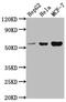 PRAME Family Member 18 antibody, CSB-PA018613LA01HU, Cusabio, Western Blot image 