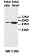 Transporter 1, ATP Binding Cassette Subfamily B Member antibody, orb76823, Biorbyt, Western Blot image 