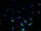 Uncoupling Protein 3 antibody, A63764-100, Epigentek, Immunofluorescence image 