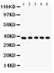 FAS antibody, PB9252, Boster Biological Technology, Western Blot image 