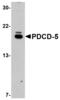 Programmed cell death protein 5 antibody, A02613, Boster Biological Technology, Western Blot image 