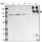 CD45 antibody, HPA000440, Atlas Antibodies, Western Blot image 