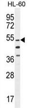 Integrator Complex Subunit 14 antibody, AP50997PU-N, Origene, Western Blot image 