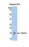 Renin-1 antibody, LS-C296221, Lifespan Biosciences, Western Blot image 