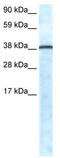 Zinc finger protein Gfi-1 antibody, TA330604, Origene, Western Blot image 