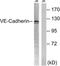 Cadherin 5 antibody, TA313596, Origene, Western Blot image 