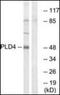 Phospholipase D Family Member 4 antibody, orb137547, Biorbyt, Western Blot image 