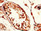 TPX2 Microtubule Nucleation Factor antibody, LS-C673551, Lifespan Biosciences, Immunohistochemistry paraffin image 