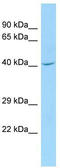 CDC42 Effector Protein 1 antibody, TA337883, Origene, Western Blot image 