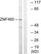 Zinc Finger Protein 460 antibody, PA5-39544, Invitrogen Antibodies, Western Blot image 