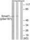 SMAD Family Member 1 antibody, LS-C199577, Lifespan Biosciences, Western Blot image 