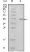 Human Papilloma Virus Type 16-E7  antibody, LS-C171421, Lifespan Biosciences, Western Blot image 
