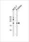 Adenine Phosphoribosyltransferase antibody, 61-584, ProSci, Western Blot image 