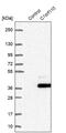 Coiled-Coil Domain Containing 190 antibody, PA5-55905, Invitrogen Antibodies, Western Blot image 